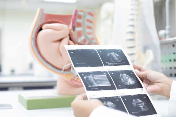 2025年泰国试管婴儿价格分析，费用明细大公开！