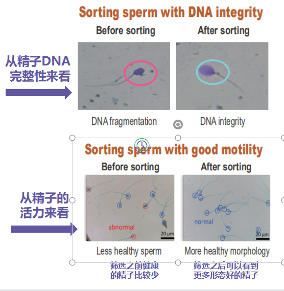 LRC配置国际高标准无尘实验室 ，提升试管成功率