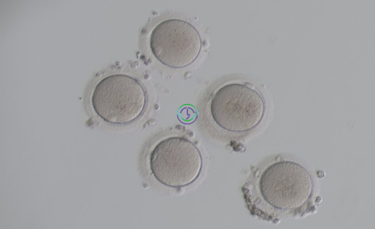 泰国LRC生殖中心 | 冻卵项目介绍（含详细流程+费用）
