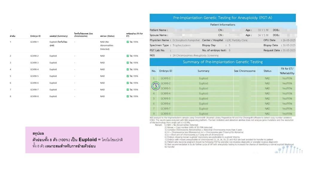 LRC助力：多囊卵巢综合征不是障碍，从不孕到三代试管婴儿的成功之路