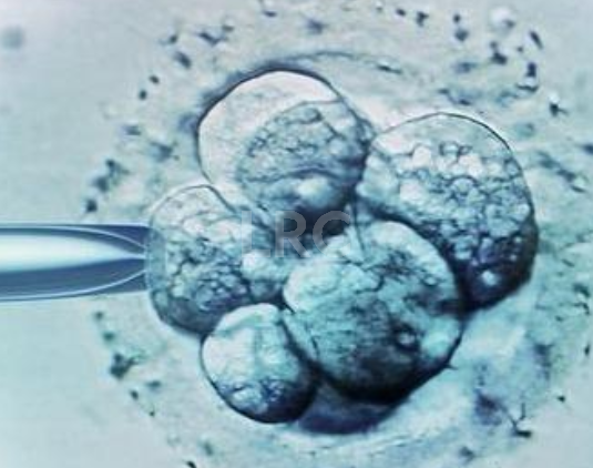 泰国冻卵花费大揭秘！看这一篇就够了！