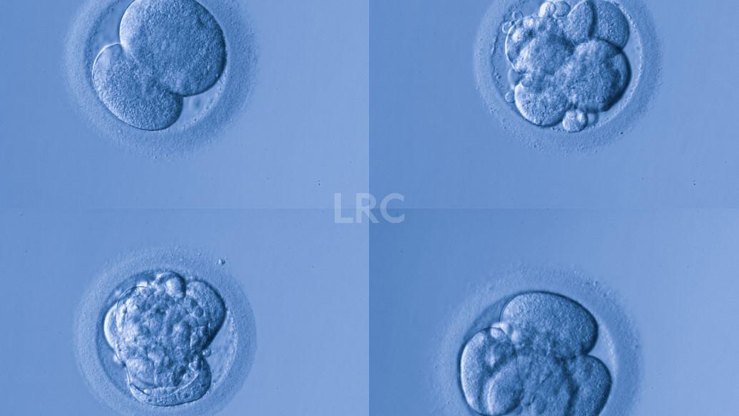 泰国冻卵医院哪家技术最先进？2026年泰国试管冻卵医院最新排行榜