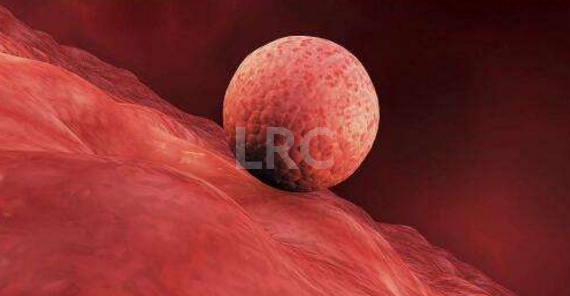 泰国LRC试管医院冻卵费用怎么样?费用清单来了!