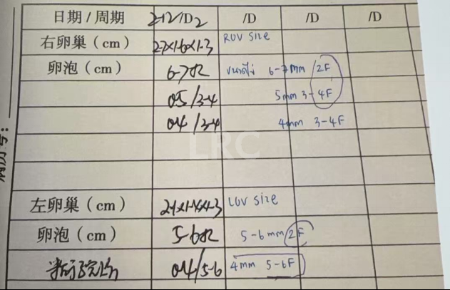37岁卵泡不均难促排，LRC精准促排实现受精养囊双百，拿下10颗囊胚！