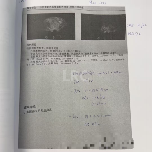 40岁卵泡不均+47岁精子双低！LRC用个性化促排盘活稀缺卵泡，4颗胚胎全成囊！