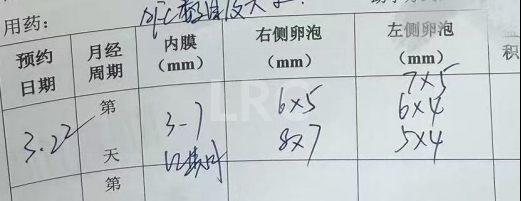 女方33岁卵巢早衰，男方精子活力仅1%！LRC个性化促排+PICSI精子技术，实现受精养囊全满分！