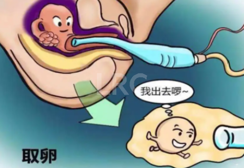 2026年泰国LRC对“畸形精子率高”有哪些提升精子质量的建议?