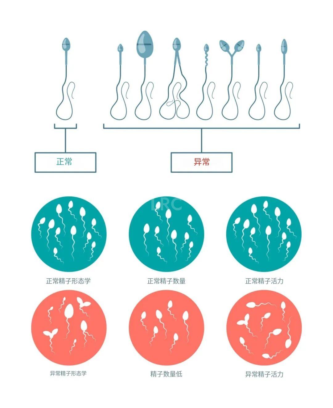 从受精到胚胎：精子质量到底影响有多大？