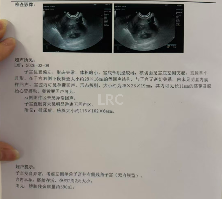 男方69岁重度弱精翻盘！LRC DGC高密梯度离心法+个性化促排方案，6周见胎心